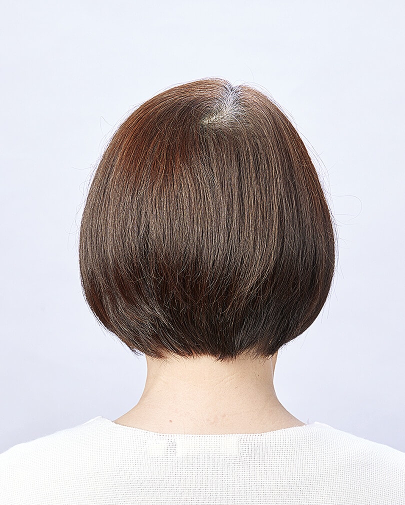 GAeのBefore写真