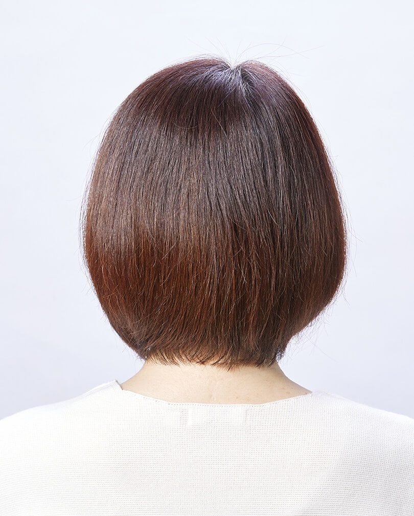 GPのBefore写真